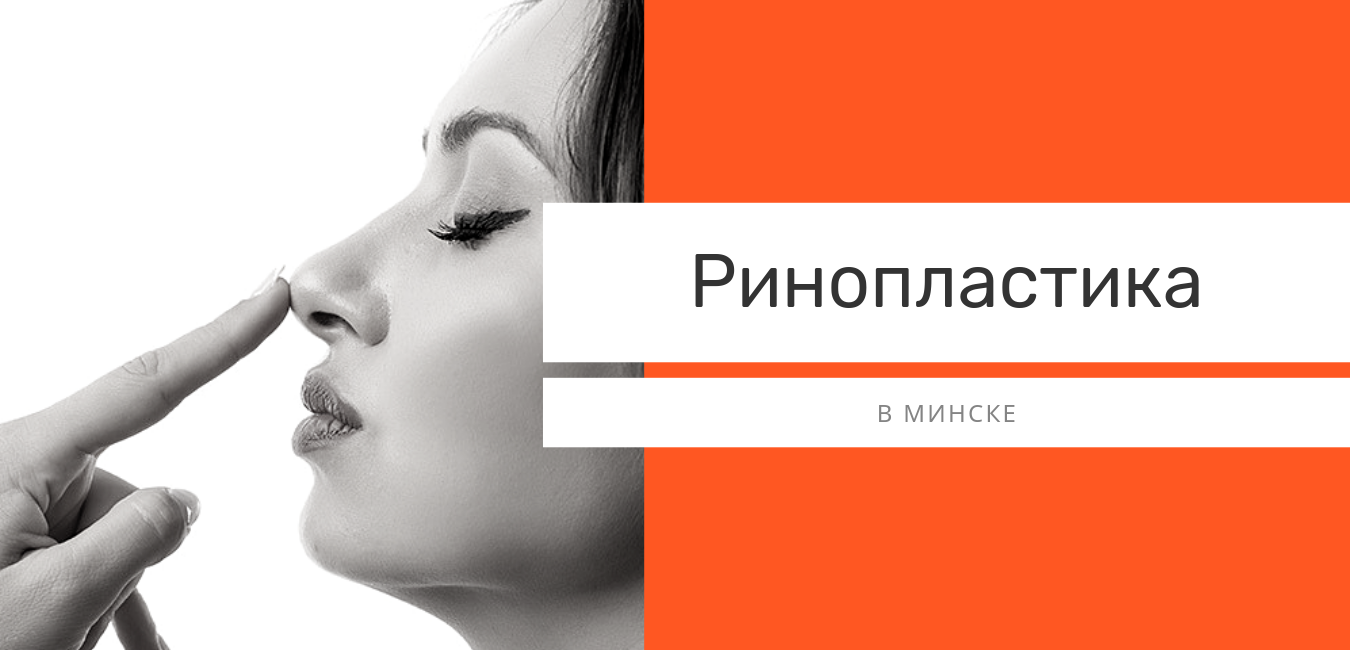 ринопластика в минске