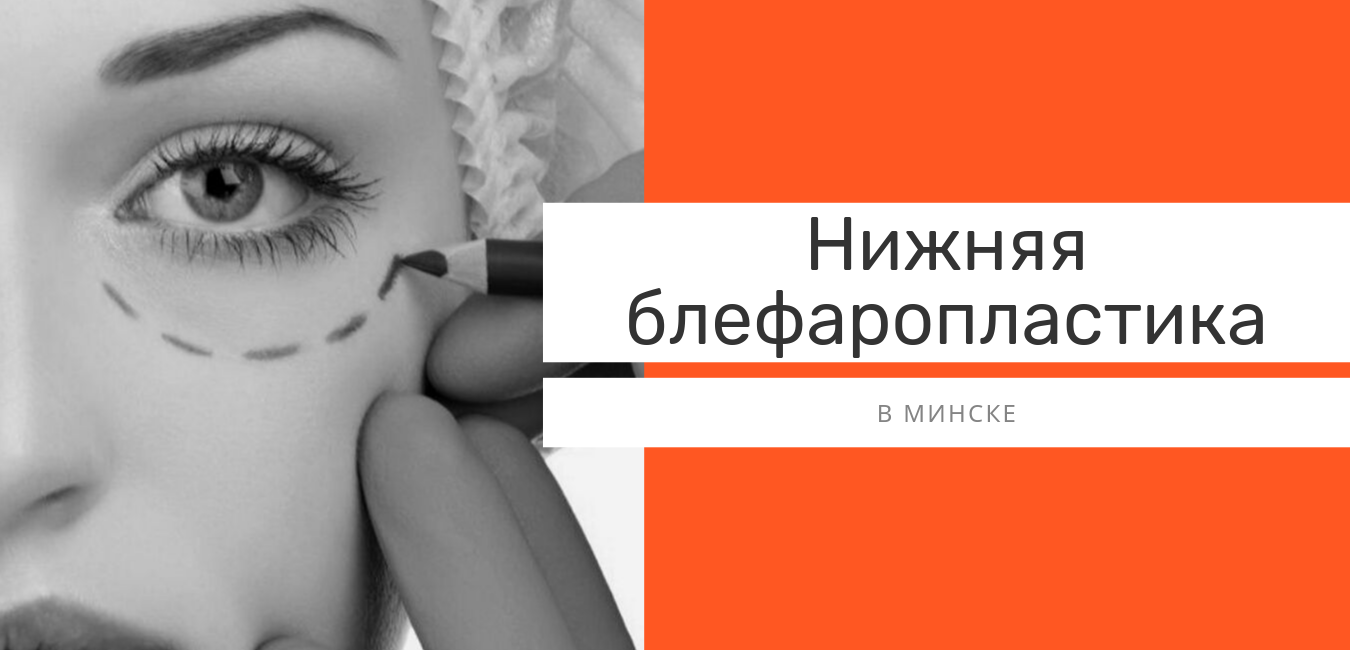 нижняя блефаропластика
